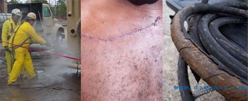 高压清洗机工作中应注意的安全问题